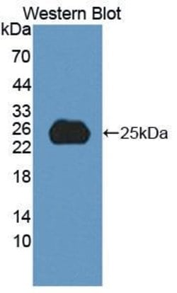 Invitrogen SPP24 Polyclonal Antibody, Invitrogen 100 &mu;L; Unconjugated:Antibodies,