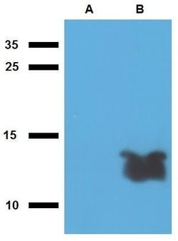 Invitrogen Mycobacterium tuberculosis Tb7.7 Polyclonal Antibody 100 &mu;g | Buy Online | Invitrogen&trade; | Fisher Scientific