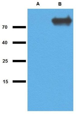 Invitrogen Mycobacterium tuberculosis GlcB Polyclonal Antibody 100 &mu;g;