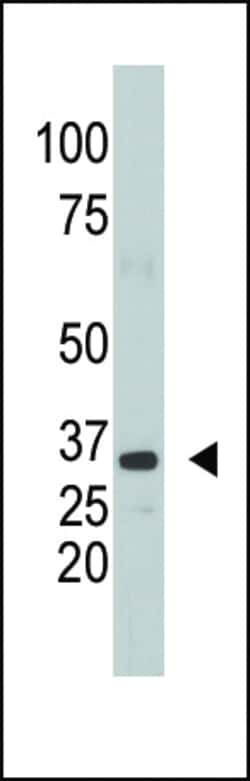 Invitrogen SULT1A1 Polyclonal Antibody 400 μL; Unconjugated:Antibodies,