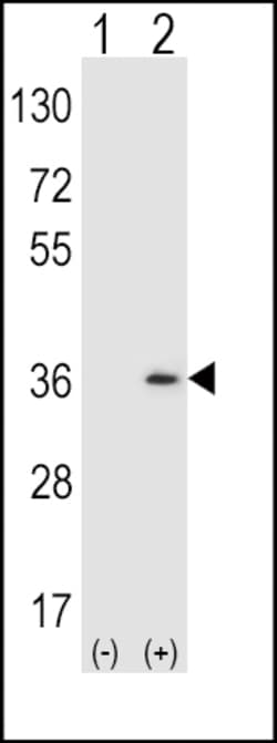 Invitrogen SULT1A1 Polyclonal Antibody 400 μL; Unconjugated:Antibodies,