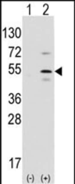 Invitrogen PTF1A Polyclonal Antibody 400 &mu;L; Unconjugated:Antibodies,