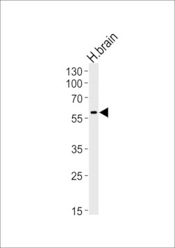 Invitrogen HERV Polyclonal Antibody 200 &mu;L; Unconjugated:Antibodies,