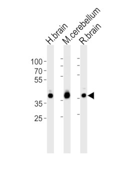Invitrogen Aldolase C Polyclonal Antibody 400 &mu;L | Buy Online | Invitrogen&trade; | Fisher Scientific