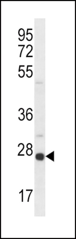 Invitrogen Sigma-1 Receptor Polyclonal Antibody 400 &mu;L; Unconjugated:Antibodies,