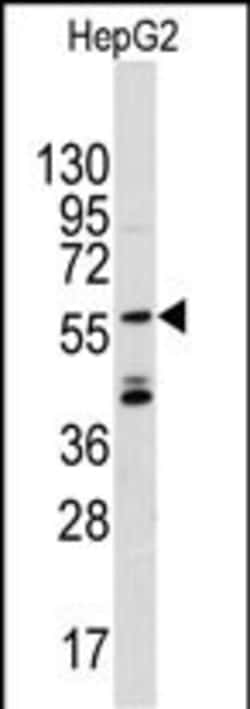 Invitrogen ANGEL2 Polyclonal Antibody 400 &mu;L; Unconjugated:Antibodies,