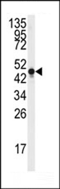 Invitrogen NSE Polyclonal Antibody 400 &mu;L; Unconjugated:Antibodies,