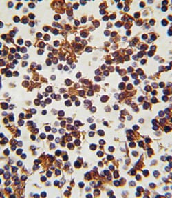 Invitrogen FOXP3 Polyclonal Antibody 400 μL; Unconjugated:Antibodies,