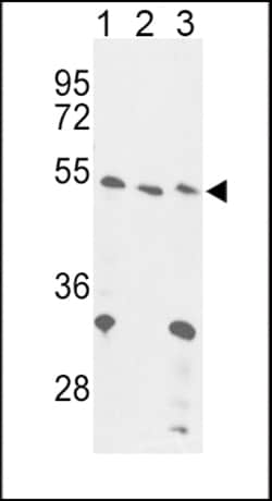 Invitrogen FOXP3 Polyclonal Antibody 400 μL; Unconjugated:Antibodies,