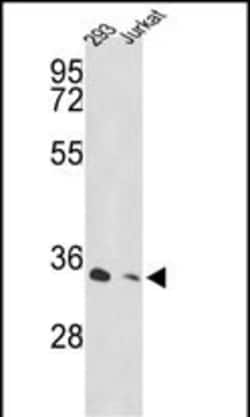 Invitrogen PSMD11 Polyclonal Antibody 400 &mu;L; Unconjugated:Antibodies,