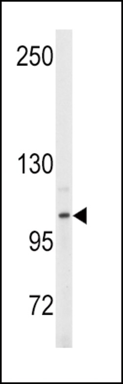 Invitrogen ENPP2 Polyclonal Antibody 400 &mu;L | Buy Online | Invitrogen&trade; | Fisher Scientific