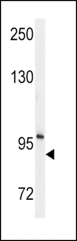 Invitrogen ENPP2 Polyclonal Antibody 400 &mu;L | Buy Online | Invitrogen&trade; | Fisher Scientific