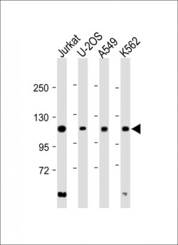 Invitrogen EXO1 Polyclonal Antibody 400 &mu;L; Unconjugated:Antibodies,