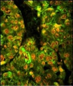 Invitrogen CD38 Polyclonal Antibody 400 &mu;L; Unconjugated:Antibodies