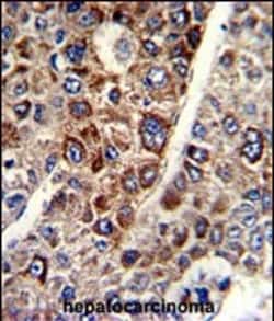 Invitrogen CD38 Polyclonal Antibody 400 &mu;L; Unconjugated:Antibodies