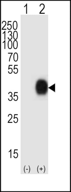 Invitrogen CD38 Polyclonal Antibody 400 &mu;L; Unconjugated:Antibodies
