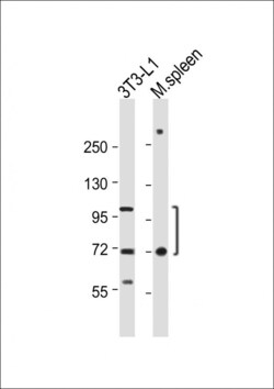Invitrogen CD36 Polyclonal Antibody 400 &mu;L; Unconjugated:Anticorps,