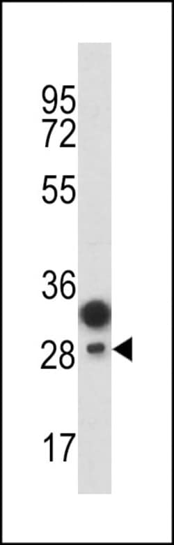 Invitrogen EPCR Polyclonal Antibody 400 &mu;L; Unconjugated:Anticuerpos