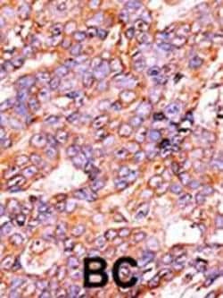Invitrogen Phospho-Histone H3 (Ser10) Polyclonal Antibody 400 &mu;L; Unconjugated:Antibodies,