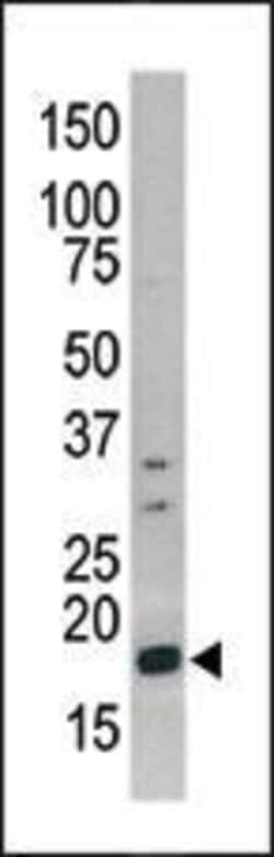 Invitrogen Phospho-Histone H3 (Ser10) Polyclonal Antibody 400 &mu;L; Unconjugated:Antibodies,