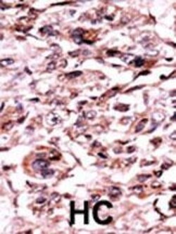 Invitrogen Phospho-c-Abl (Tyr245) Polyclonal Antibody 400 &mu;L; Unconjugated:Antikörper