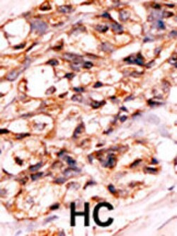 Invitrogen Phospho-BAD (Ser118) Polyclonal Antibody 400 &mu;L | Buy Online | Invitrogen&trade; | Fisher Scientific