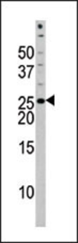Invitrogen Phospho-BAD (Ser118) Polyclonal Antibody 400 &mu;L | Buy Online | Invitrogen&trade; | Fisher Scientific
