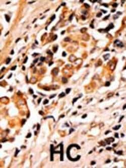 Invitrogen Phospho-BAD (Ser75) Polyclonal Antibody 400 &mu;L; Unconjugated:Anticuerpos