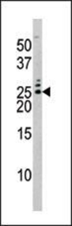 Invitrogen Phospho-BAD (Ser75) Polyclonal Antibody 400 &mu;L; Unconjugated:Anticuerpos