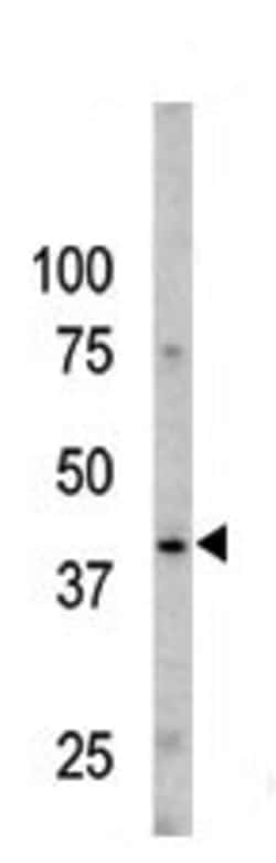 Invitrogen Phospho-Caspase 9 (Ser196) Polyclonal Antibody 400 &mu;L | Buy Online | Invitrogen&trade; | Fisher Scientific