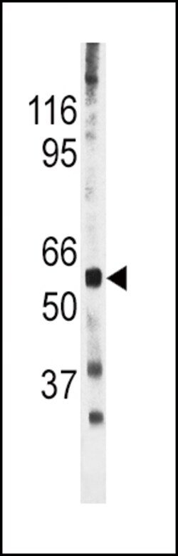 Invitrogen Phospho-Cdc25A (Ser278) Polyclonal Antibody 400 &mu;L | Buy Online | Invitrogen&trade; | Fisher Scientific