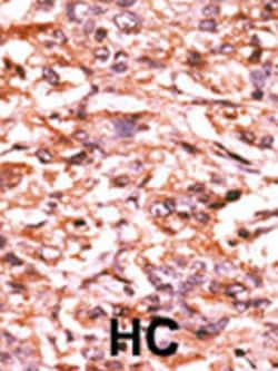 Invitrogen Phospho-Cdc25B (Ser187) Polyclonal Antibody 400 &mu;L; Unconjugated:Antibodies,