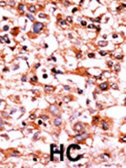 Invitrogen Phospho-CDK1 (Ser39) Polyclonal Antibody 400 &mu;L | Buy Online | Invitrogen&trade; | Fisher Scientific