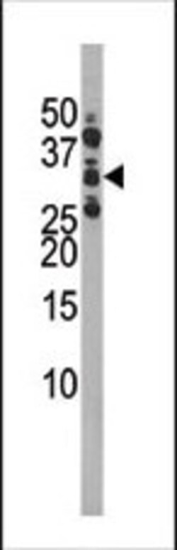 Invitrogen Phospho-CDK1 (Ser39) Polyclonal Antibody 400 &mu;L | Buy Online | Invitrogen&trade; | Fisher Scientific