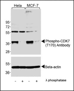 Invitrogen Phospho-CDK7 (Thr170) Polyclonal Antibody 400 &mu;L; Unconjugated:Antibodies,