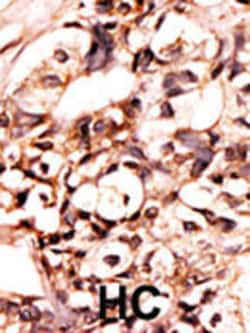Invitrogen Phospho-DAXX (Ser213) Polyclonal Antibody 400 &mu;L; Unconjugated:Antibodies,