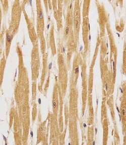 Phospho-ErbB4 (Tyr1162) Polyclonal Antibody:Antibodies, Polyclonal