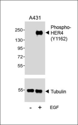 Phospho-ErbB4 (Tyr1162) Polyclonal Antibody:Antibodies, Polyclonal