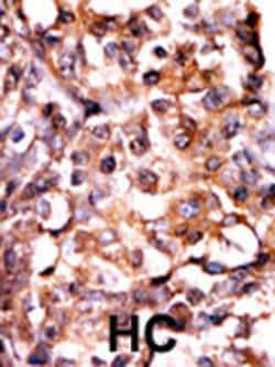 Invitrogen Phospho-MAPKAPK2 (Ser272) Polyclonal Antibody 400 &mu;L; Unconjugated:Antibodies,