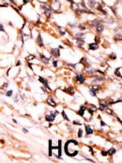 Invitrogen Phospho-PRAK (Ser93) Polyclonal Antibody 400 &mu;L; Unconjugated:Antibodies,