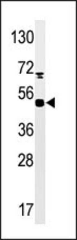 Invitrogen Phospho-PRAK (Ser93) Polyclonal Antibody 400 &mu;L; Unconjugated:Antibodies,