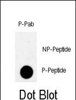 Invitrogen Phospho-PKMYT1 (Thr495) Polyclonal Antibody 400 &mu;L; Unconjugated:Antibodies,