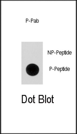 Invitrogen Phospho-p21 (Ser130) Polyclonal Antibody 400 μL; Unconjugated:Antibodies,