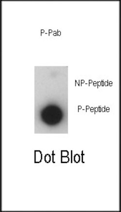 Invitrogen Phospho-p21 (Thr57) Polyclonal Antibody 400 &mu;L; Unconjugated:Antibodies,