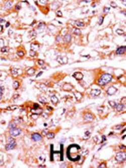 Invitrogen Phospho-p21 (Thr57) Polyclonal Antibody 400 &mu;L; Unconjugated:Antibodies,