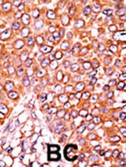 Invitrogen Phospho-p27 Kip1 (Thr157) Polyclonal Antibody 400 &mu;L; Unconjugated:Antibodies,