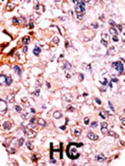 Invitrogen Phospho-p27 Kip1 (Thr187) Polyclonal Antibody 400 &mu;L; Unconjugated:Antibodies,