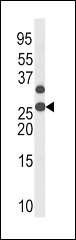 Invitrogen Phospho-p27 Kip1 (Thr187) Polyclonal Antibody 400 &mu;L; Unconjugated:Antibodies,