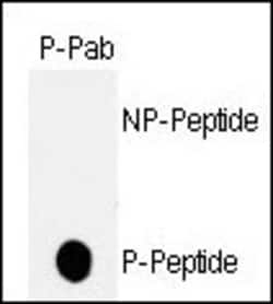 Invitrogen Phospho-p53 (Thr18) Polyclonal Antibody 400 &mu;L; Unconjugated:Antibodies,