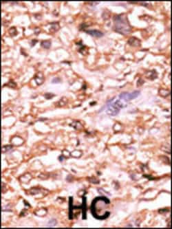 Invitrogen Phospho-p53 (Thr18) Polyclonal Antibody 400 &mu;L; Unconjugated:Antibodies,